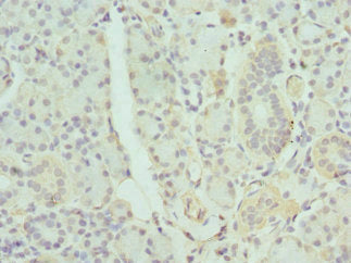 GDA Polyclonal Antibody - image 3