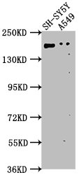 GLI2 Polyclonal Antibody - image 3