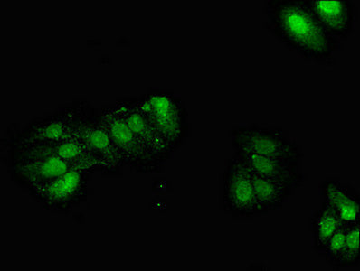 GPX2 Polyclonal Antibody - image 2