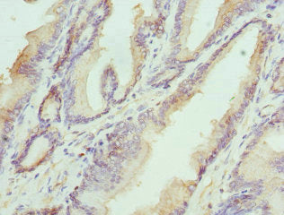 HAPLN1 Polyclonal Antibody - image 3