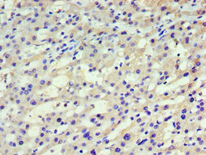 Immunoprecipitating HARS in Hela whole cell lysate, Lane 1: Rabbit control IgG instead of (1ug) instead of CAC13060 in Hela whole cell lysate., For western blotting, a HRP-conjugated anti-rabbit IgG, specific to the non-reduced form of IgG was used as the Secondary antibody (1/50000), Lane 2: CAC13060 (4ug) + Hela whole cell lysate (500ug), Lane 3: Hela whole cell lysate (20ug)
