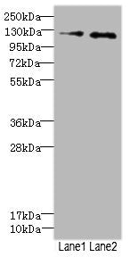 Immunohistochemistry of paraffin-embedded human pancreatic cancer using CAC13062 at dilution of 1:100