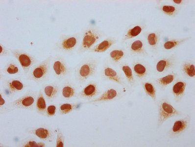 Immunofluorescence staining of Hela cells (treated with 30mM sodium butyrate for 4h) with CAC13065 at 1:5, counter-stained with DAPI. The cells were fixed in 4% formaldehyde, permeabilized using 0.2% Triton X-100 and blocked in 10% normal Goat Serum. The cells were then incubated with the antibody overnight at 4°C. The secondary antibody was Alexa Fluor 488-congugated AffiniPure Goat Anti-Rabbit IgG(H+L).