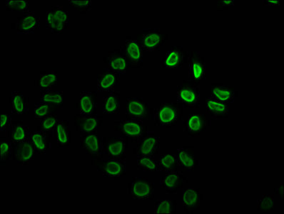 2-hydroxyisobutyryl-HIST1H2BC (K34) Polyclonal Antibody - image 4