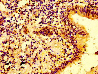 Immunofluorescence staining of PC-3 cells with CAC13083 at 1:100, counter-stained with DAPI. The cells were fixed in 4% formaldehyde, permeabilized using 0.2% Triton X-100 and blocked in 10% normal Goat Serum. The cells were then incubated with the antibody overnight at 4°C. The secondary antibody was Alexa Fluor 488-congugated AffiniPure Goat Anti-Rabbit IgG(H+L).