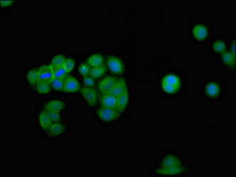 IFNGR2 Polyclonal Antibody - image 4