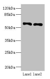 Immunohistochemistry of paraffin-embedded human placenta tissue using CAC13084 at dilution of 1:100