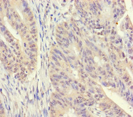 Immunohistochemistry of paraffin-embedded human appendix tissue using CAC13085 at dilution of 1:100