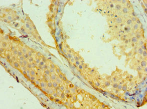 Immunoprecipitating MAGEA1 in Hela whole cell lysate, Lane 1: Rabbit control IgG instead of CAC13106 in Hela whole cell lysate. For western blotting, a HRP-conjugated Protein G antibody was used as the secondary antibody (1/2000), Lane 2: CAC13106 (8ug) + Hela whole cell lysate (500ug), Lane 3: Hela whole cell lysate (10ug)