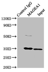 MAGEA1 Polyclonal Antibody - image 4