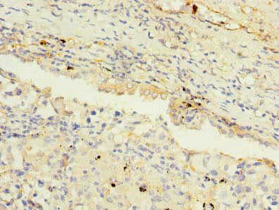 MAGEA9 Polyclonal Antibody - image 3