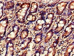Immunofluorescent analysis of PC-3 cells using CAC13108 at dilution of 1:100 and Alexa Fluor 488-congugated AffiniPure Goat Anti-Rabbit IgG(H+L)