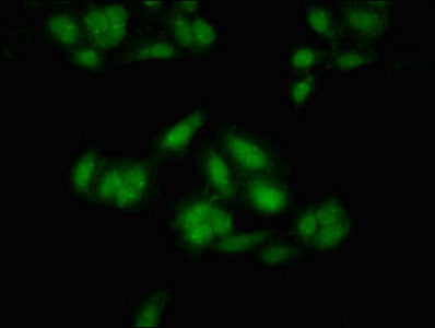 MEIS2 Polyclonal Antibody - image 3