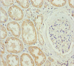 Immunohistochemistry of paraffin-embedded human heart tissue using CAC13125 at dilution of 1:100