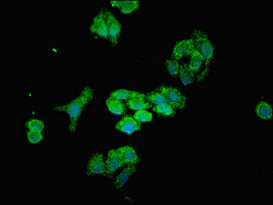 MTX2 Polyclonal Antibody - image 5