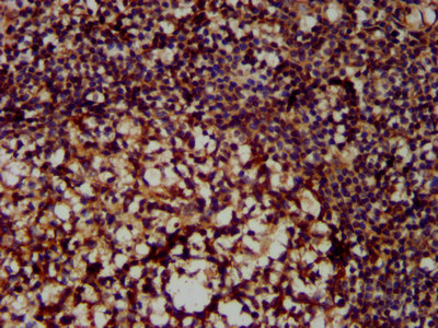 Immunofluorescence staining of Hela cells with CAC13127 at 1:100, counter-stained with DAPI. The cells were fixed in 4% formaldehyde, permeabilized using 0.2% Triton X-100 and blocked in 10% normal Goat Serum. The cells were then incubated with the antibody overnight at 4°C. The secondary antibody was Alexa Fluor 488-congugated AffiniPure Goat Anti-Rabbit IgG(H+L).