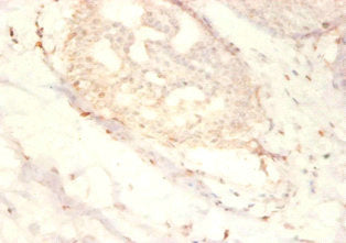 Immunofluorescent analysis of Hela cells using CAC13129 at dilution of 1:100 and Alexa Fluor 488-congugated AffiniPure Goat Anti-Rabbit IgG(H+L)
