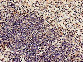 Immunocytochemistry analysis of human lung tissue using CAC13132 at dilution of 1:100