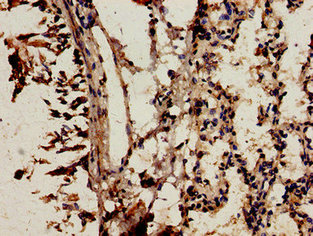 Immunofluorescent analysis of Hela cells using CAC13132 at dilution of 1:100 and Alexa Fluor 488-congugated AffiniPure Goat Anti-Rabbit IgG(H+L)