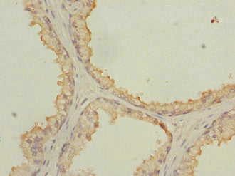 Immunoprecipitating NMT2 in HepG2 whole cell lysate, Lane 1: Rabbit control IgG instead of (1ug) instead of CAC13136 in HepG2 whole cell lysate., For western blotting, a HRP-conjugated anti-rabbit IgG, specific to the non-reduced form of IgG was used as the Secondary antibody (1/50000), Lane 2: CAC13136 (4ug) + HepG2 whole cell lysate (500ug), Lane 3: HepG2 whole cell lysate (20ug)