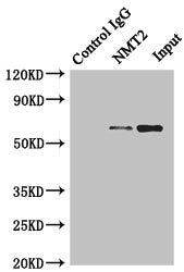 NMT2 Polyclonal Antibody - image 4