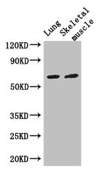 Immunohistochemistry of paraffin-embedded human brain tissue using CAC13147 at dilution of 1:100