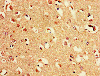 Immunofluorescent analysis of Hela cells using CAC13147 at dilution of 1:100 and Alexa Fluor 488-congugated AffiniPure Goat Anti-Rabbit IgG(H+L)