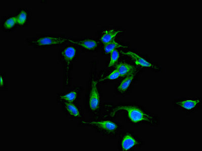 PAK3 Polyclonal Antibody - image 4