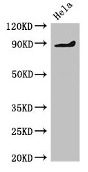Immunohistochemistry of paraffin-embedded human kidney tissue using CAC13151 at dilution of 1:100