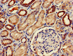 Immunohistochemistry of paraffin-embedded human adrenal gland tissue using CAC13151 at dilution of 1:100