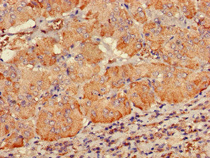 Immunofluorescent analysis of HepG2 cells using CAC13151 at dilution of 1:100 and Alexa Fluor 488-congugated AffiniPure Goat Anti-Rabbit IgG(H+L)