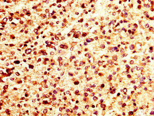 PF4 Polyclonal Antibody - image 2