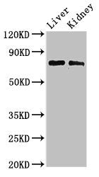 Immunohistochemistry of paraffin-embedded human liver cancer using CAC13158 at dilution of 1:100