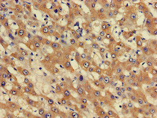 Immunohistochemistry of paraffin-embedded human adrenal gland tissue using CAC13158 at dilution of 1:100