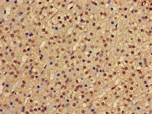 Immunofluorescent analysis of Hela cells using CAC13158 at dilution of 1:100 and Alexa Fluor 488-congugated AffiniPure Goat Anti-Rabbit IgG(H+L)