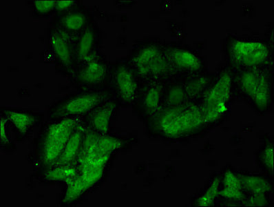 PHF21A Polyclonal Antibody - image 5