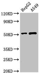 Immunohistochemistry of paraffin-embedded human kidney tissue using CAC13162 at dilution of 1:100