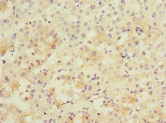 Immunohistochemistry of paraffin-embedded human small intestine tissue using CAC13167 at dilution of 1:100