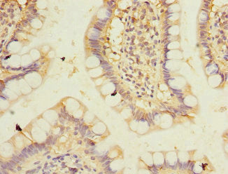 PPM1D Polyclonal Antibody - image 4