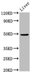 IHC image of CAC13168 diluted at 1:100 and staining in paraffin-embedded human melanoma performed on a Leica BondTM system. After dewaxing and hydration, antigen retrieval was mediated by high pressure in a citrate buffer (pH 6.0). Section was blocked with 10% normal goat serum 30min at RT. Then primary antibody (1% BSA) was incubated at 4°C overnight. The primary is detected by a biotinylated secondary antibody and visualized using an HRP conjugated SP system.