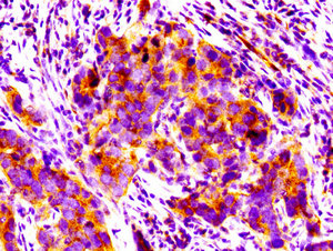 Immunofluorescence staining of HepG2 cells with CAC13168 at 1:100, counter-stained with DAPI. The cells were fixed in 4% formaldehyde, permeabilized using 0.2% Triton X-100 and blocked in 10% normal Goat Serum. The cells were then incubated with the antibody overnight at 4°C. The secondary antibody was Alexa Fluor 488-congugated AffiniPure Goat Anti-Rabbit IgG(H+L).