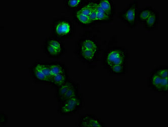 PPM1F Polyclonal Antibody - image 5