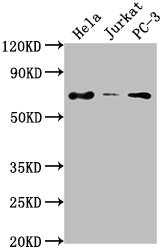 IHC image of CAC13172 diluted at 1:100 and staining in paraffin-embedded human heart tissue performed on a Leica BondTM system. After dewaxing and hydration, antigen retrieval was mediated by high pressure in a citrate buffer (pH 6.0). Section was blocked with 10% normal goat serum 30min at RT. Then primary antibody (1% BSA) was incubated at 4°C overnight. The primary is detected by a biotinylated secondary antibody and visualized using an HRP conjugated SP system.