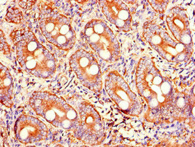PRSS2 Polyclonal Antibody - image 3