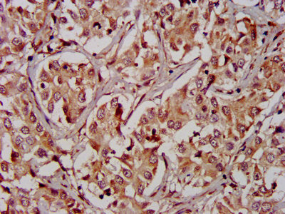 IHC image of CAC13187 diluted at 1:400 and staining in paraffin-embedded human placenta tissue performed on a Leica BondTM system. After dewaxing and hydration, antigen retrieval was mediated by high pressure in a citrate buffer (pH 6.0). Section was blocked with 10% normal goat serum 30min at RT. Then primary antibody (1% BSA) was incubated at 4°C overnight. The primary is detected by a biotinylated secondary antibody and visualized using an HRP conjugated SP system.