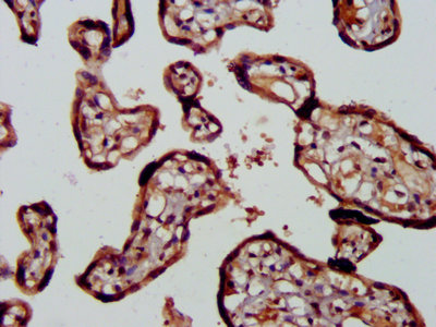 Immunofluorescence staining of Hela cells with CAC13187 at 1:133, counter-stained with DAPI. The cells were fixed in 4% formaldehyde, permeabilized using 0.2% Triton X-100 and blocked in 10% normal Goat Serum. The cells were then incubated with the antibody overnight at 4°C. The secondary antibody was Alexa Fluor 488-congugated AffiniPure Goat Anti-Rabbit IgG(H+L).