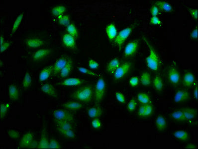 RIPK2 Polyclonal Antibody - image 5