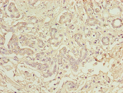 TBCC Polyclonal Antibody - image 4