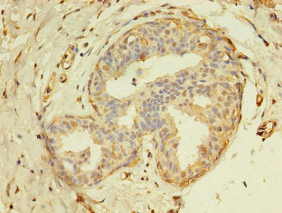 THRA Polyclonal Antibody - image 4