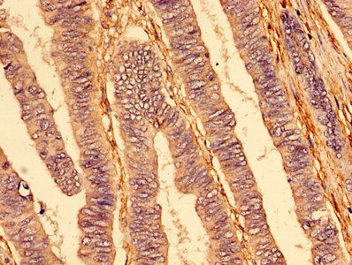 Immunofluorescent analysis of A549 cells using CAC13229 at dilution of 1:100 and Alexa Fluor 488-congugated AffiniPure Goat Anti-Rabbit IgG(H+L)